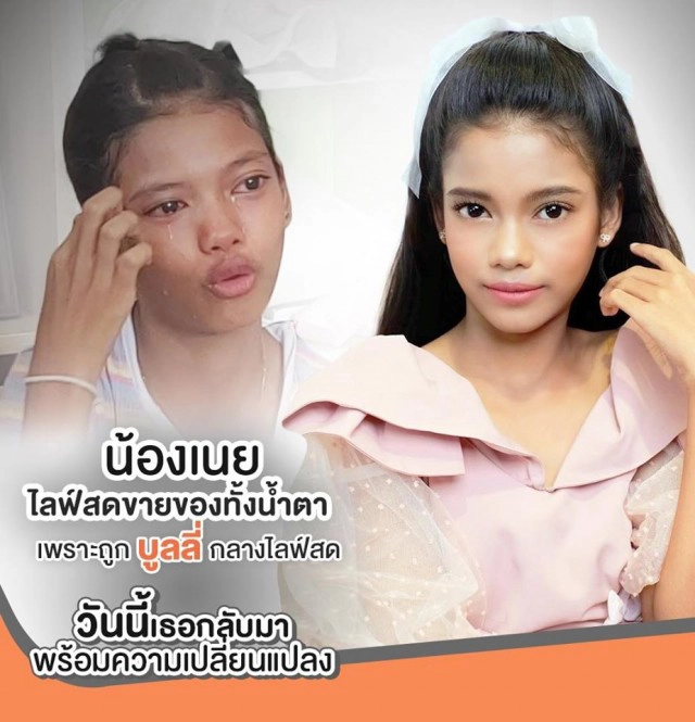 เปลี่ยนลุค "น้องเนย" เด็กหญิงโดนบุลลี่หน้าตา สวยพร้อมประกวด Miss Universe