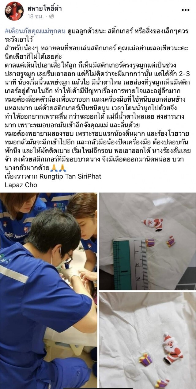 แม่แชร์ประสบการณ์ ลูกน้อยเอาสติกเกอร์ยัดรูจมูก ทำหมอปาดเหงื่อ สุดท้ายโดนจับมัด
