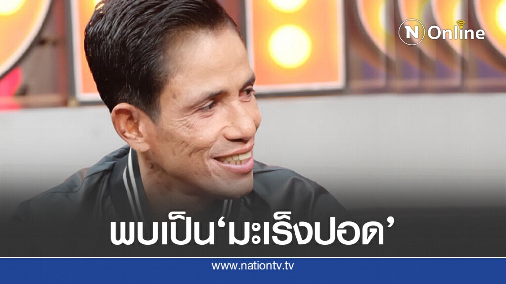 'โรเบิร์ต สายควัน'พบมะเร็งปอด 'โรเบิร์ต สายควัน'พบมะเร็งปอด