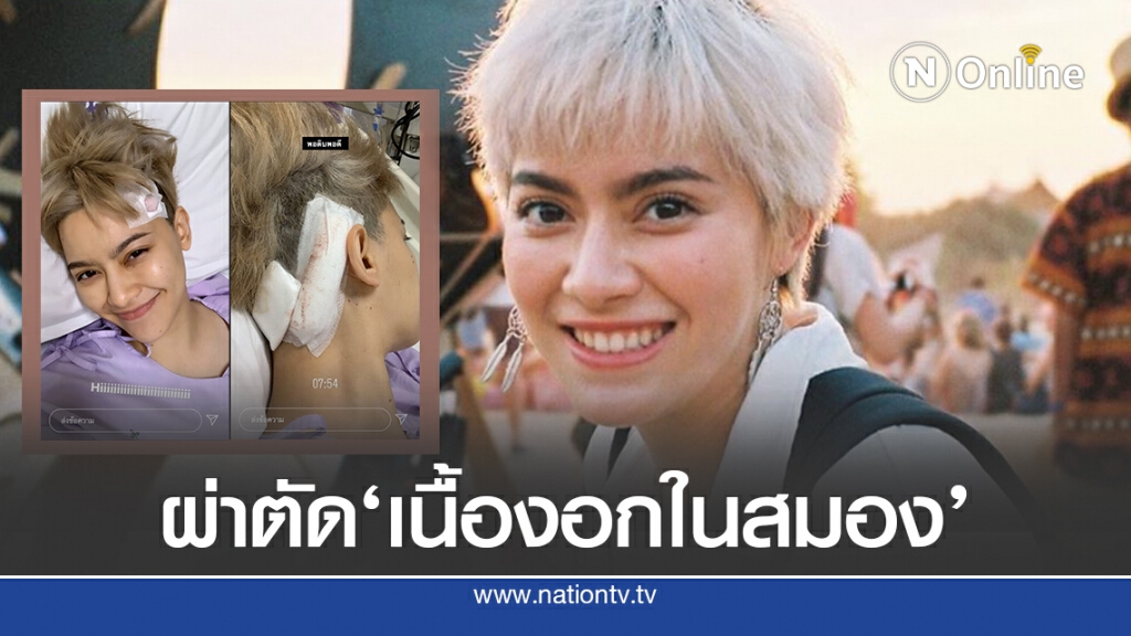 'นิ้ง ชัญญา'เปิดภาพหลังผ่าตัดเนื้องอกผ่านไปด้วยดี