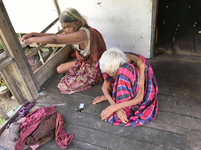 คุณยายวัย 103 ปี อยู่กับลูกเป็นออทิสติก สุดน่าสงสารเห็นแล้วบีบหัวใจ