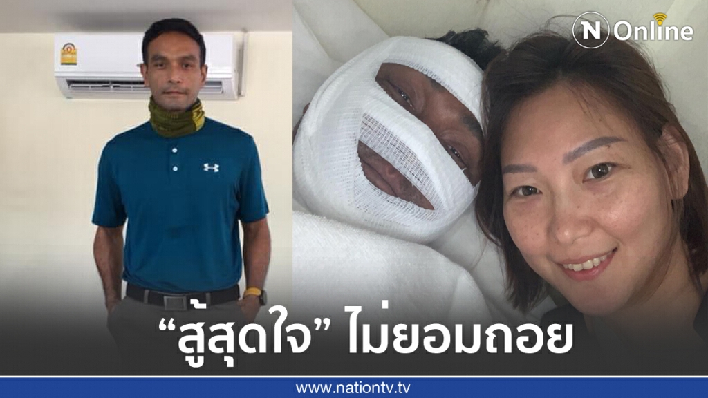 "วินัย ไกรบุตร" พันผ้าก็อซทั่วหน้า หน้าบวมหนัก ต้องบำบัดต่อเนื่อง "วินัย ไกรบุตร" พันผ้าก็อซทั่วหน้า หน้าบวมหนัก ต้องบำบัดต่อเนื่อง