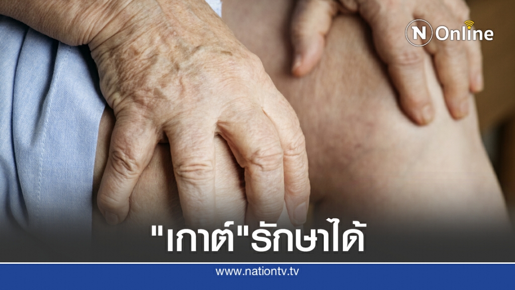 แพทย์แนะโรคเกาต์รักษาได้ ด้วยวิธีง่ายๆ โดยไม่ต้องพึ่งยา
