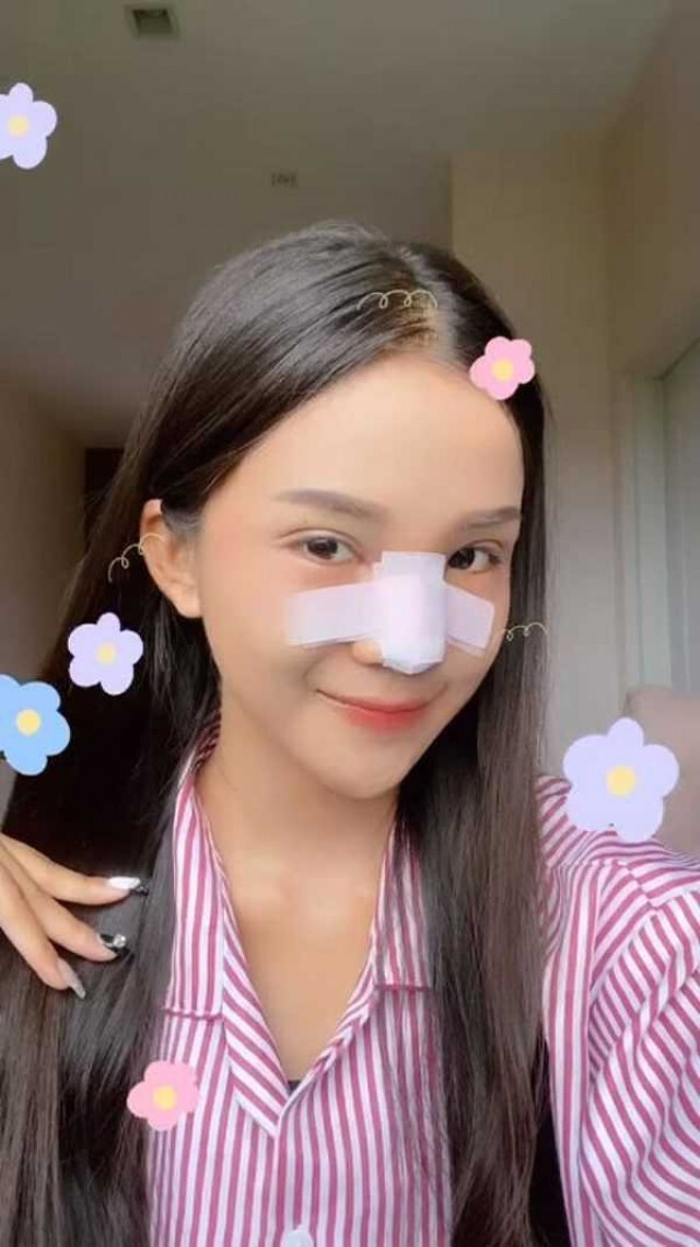 "อาม ชุติมา" ออร่าจับ ทำจมูกใหม่ สวยพุ่งกว่าเดิม เตรียมเสริมหน้าอกต่อ