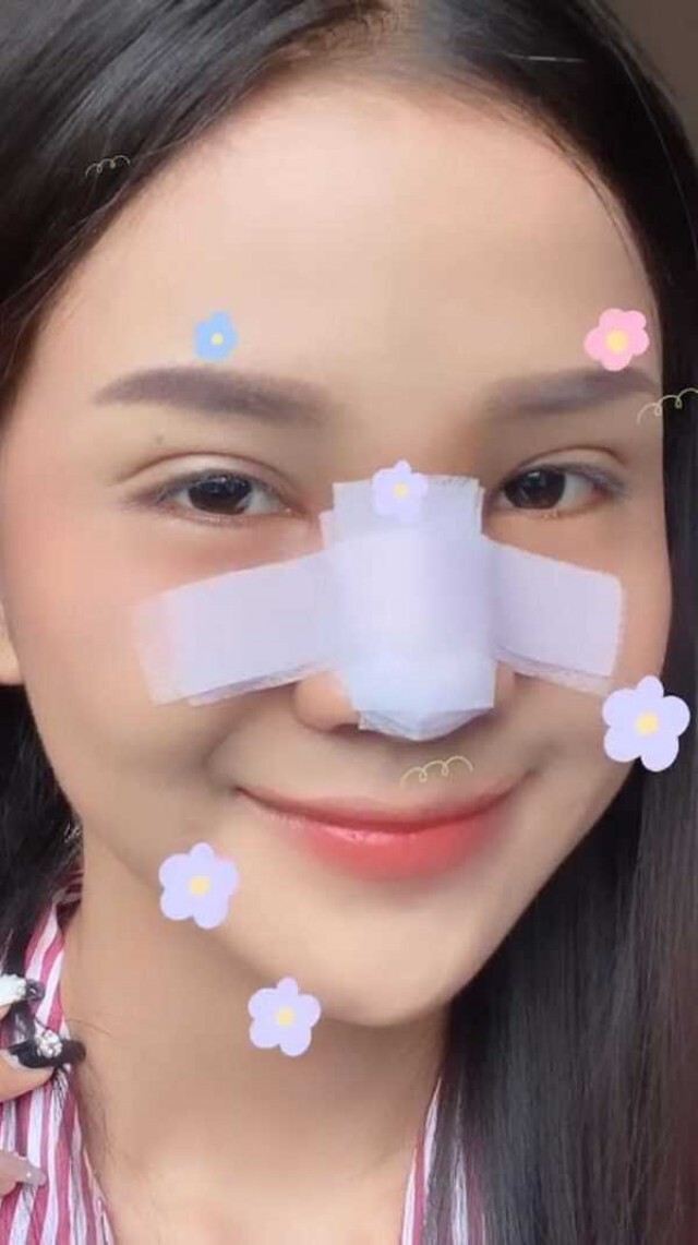 "อาม ชุติมา" ออร่าจับ ทำจมูกใหม่ สวยพุ่งกว่าเดิม เตรียมเสริมหน้าอกต่อ