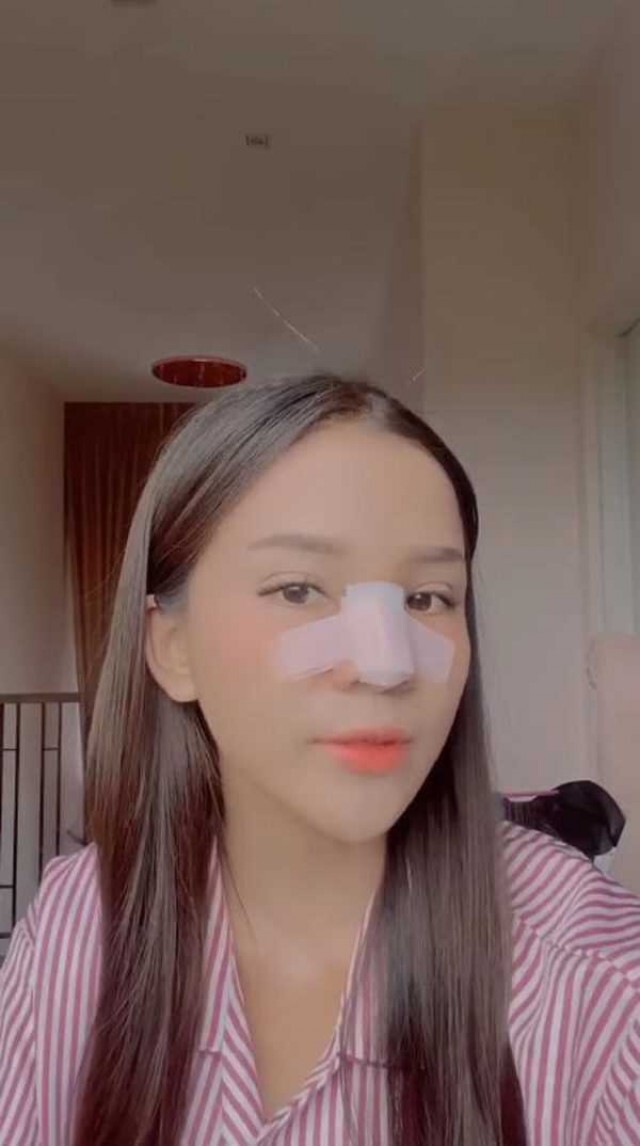 "อาม ชุติมา" ออร่าจับ ทำจมูกใหม่ สวยพุ่งกว่าเดิม เตรียมเสริมหน้าอกต่อ