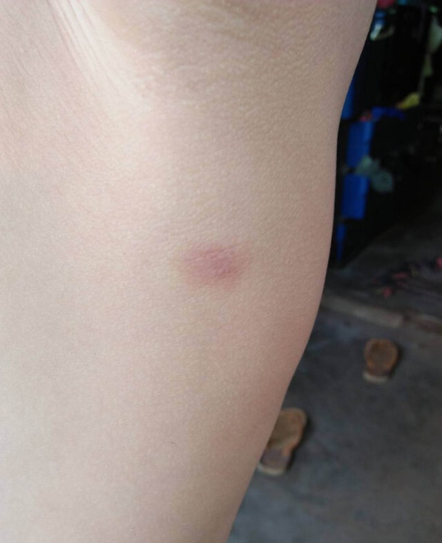 แม่ร้องสื่อลูก 6 ขวบถูกครูทำร้ายร่างกาย