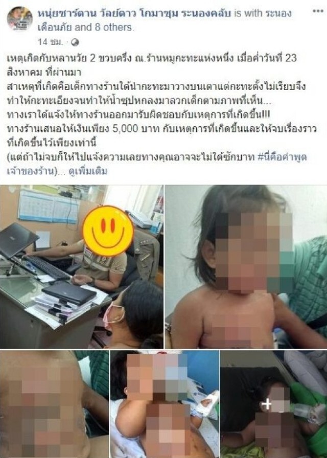 โซเชียลแฉ ร้านหมูกระทะทำน้ำซุปลวกหลานวัย 2 ขวบ แผลถลอกกว้าง เจรจาขอจบเรื่อง 5 พันบาท