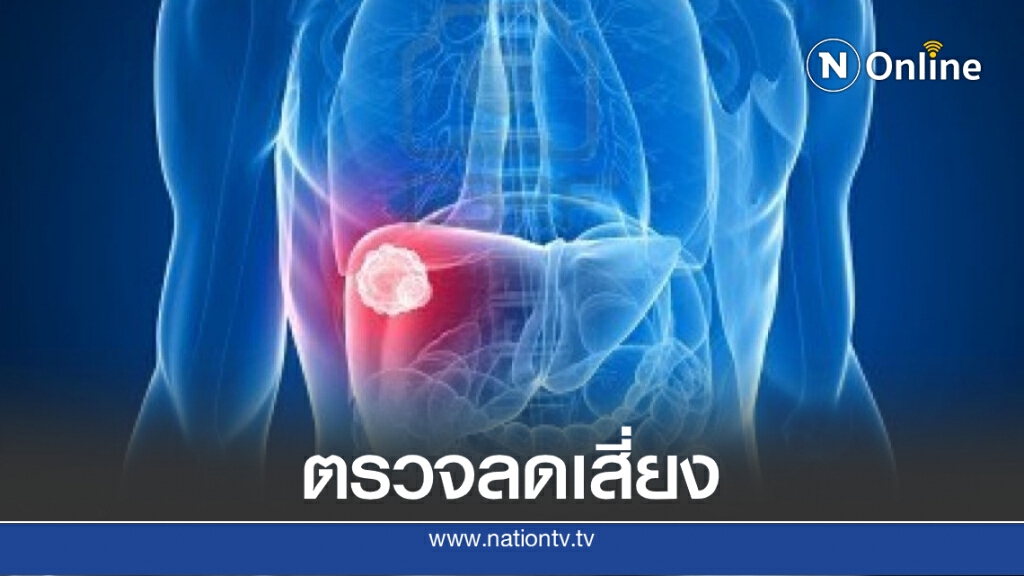แนะดูแลตัวเองป้องกัน "ไวรัสตับอักเสบบี" ต้นเหตุมะเร็งตับ แนะดูแลตัวเองป้องกัน "ไวรัสตับอักเสบบี" ต้นเหตุมะเร็งตับ