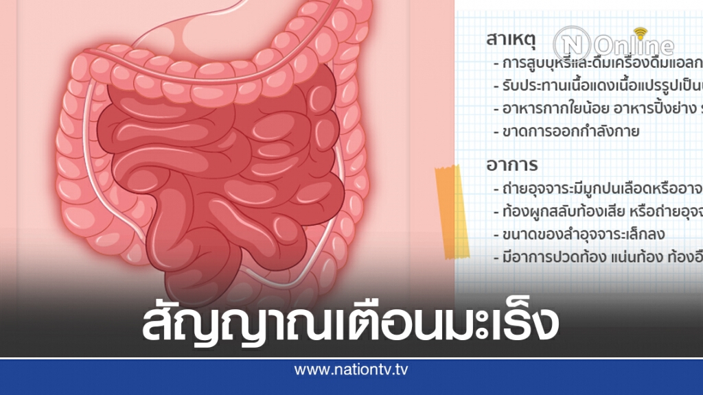 ถ่ายเป็นเลือดสัญญาณเตือน "โรคมะเร็งลำไส้ใหญ่"
