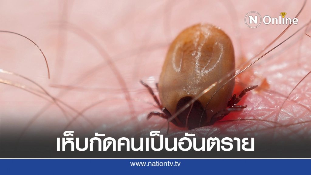 แพทย์ผิวหนังเตือนเห็บกัดคน มีอันตราย