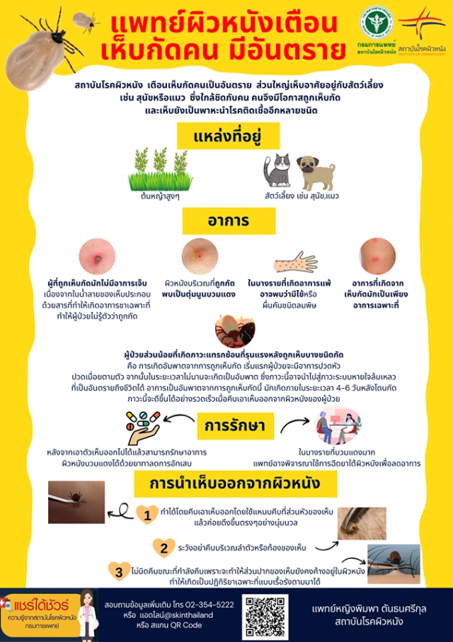 แพทย์ผิวหนังเตือนเห็บกัดคน มีอันตราย