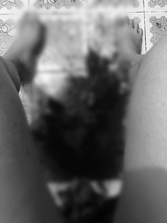 คุณแม่ลูก 2 เล่าประสบการณ์ เสียเลือดหลังคลอดจนช็อก