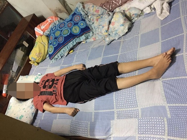 เปิดประมูลภาพ "รอฟ้า หลังฝน"หารายได้ช่วยผู้ป่วยติดเตียง28ปี