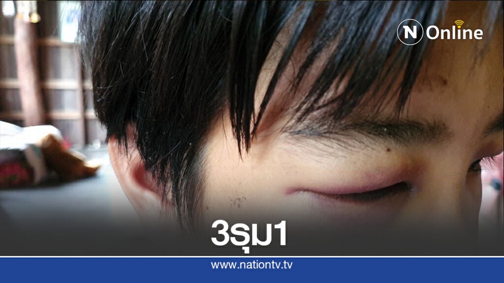 แชร์ว่อน! รุมกระทืบเด็กชายวัย14ปี