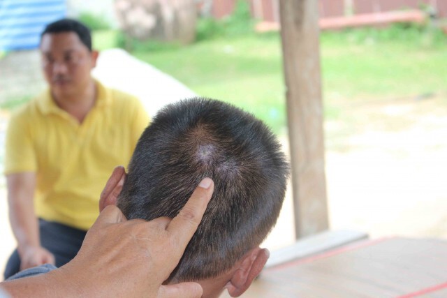 ผญบ.ฟันศอกลูกบ้านหัวน็อคพื้นเลือดคลั่งในสมอง