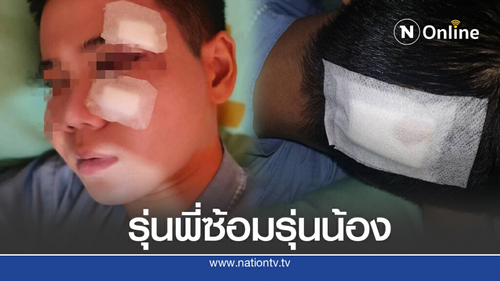 พี่เหยื่อแฉรุ่นพี่โหดซ้อมรุ่นน้อง แถมขู่หากแจ้งความมีเรื่อง โรงเรียนนิ่งเฉย