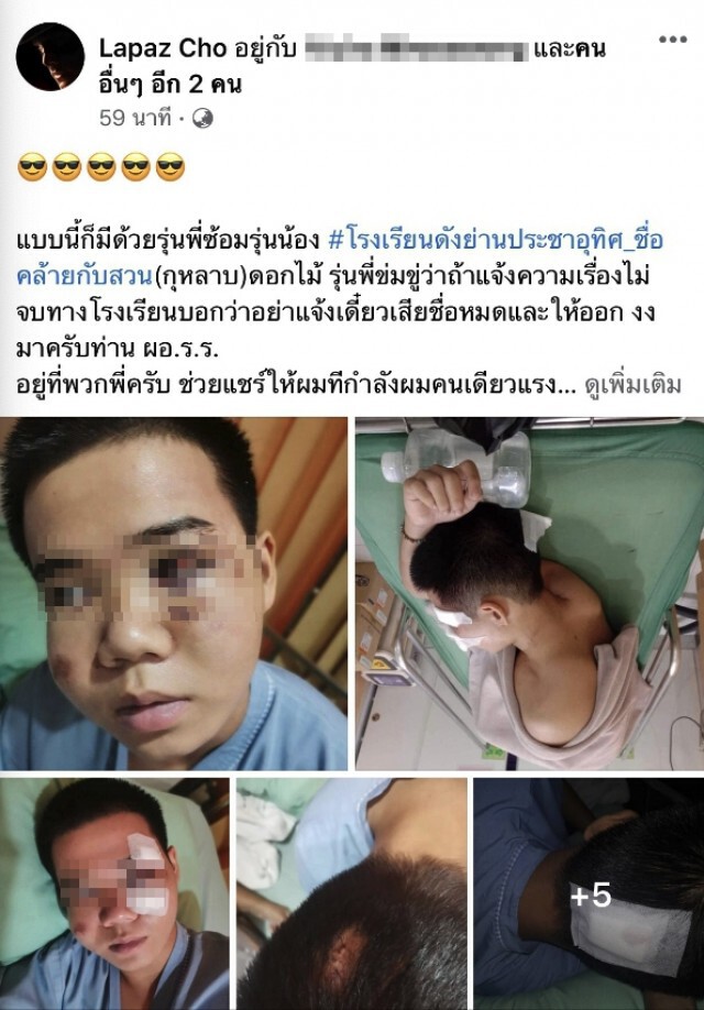 พี่เหยื่อแฉรุ่นพี่โหดซ้อมรุ่นน้อง แถมขู่หากแจ้งความมีเรื่อง โรงเรียนนิ่งเฉย