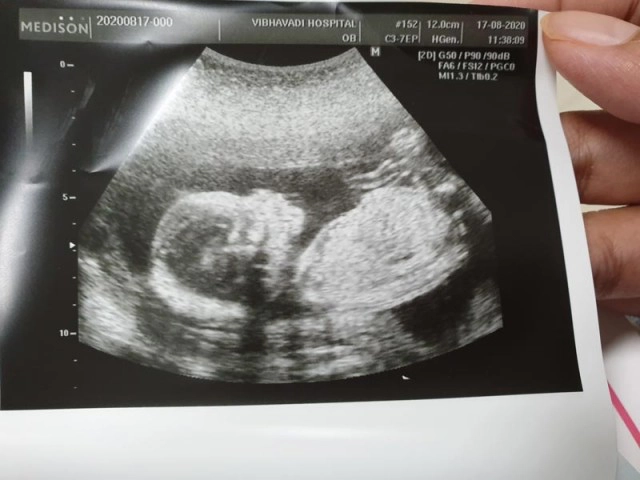 "นิกกี้ พิ้ม" ว่าที่คุณพ่อป้ายแดง ภรรยาตั้งท้องลูกคนแรกแล้ว