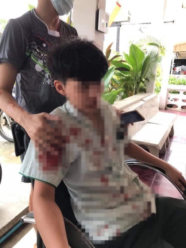 ผู้เช่าสุดทน ถูกเจ้าของบ้านเช่าคุกคาม อ้างความเป็นเจ้าของบ้าน ตัดสินใจย้ายออกดันถูกฟาดเลือดอาบ