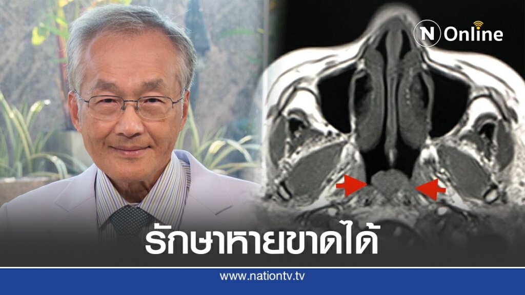 "หมอมนูญ" เผยวัณโรคหลังโพรงจมูก รักษาหายขาดได้ด้วยการกินยารักษาวัณโรค