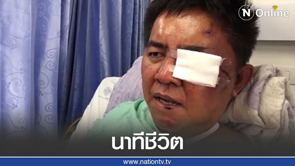 "ผู้กองปูเค็ม" เผยนาทีถูกรุมทำร้าย คาดเป็นฝีมือของกลุ่มตู้สล็อต
