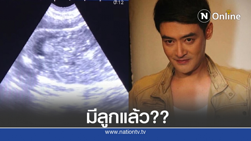 "เติ้ล ธนพล" โพสต์คลิปอัลตราซาวด์ ทำเอาชาวเน็ตสงสัย แต่งงานไปตอนไหน?? "เติ้ล ธนพล" โพสต์คลิปอัลตราซาวด์ ทำเอาชาวเน็ตสงสัย แต่งงานไปตอนไหน??