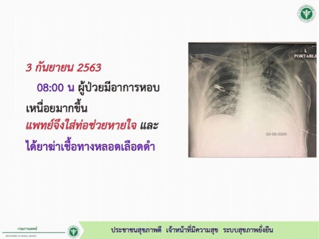 เปิดไทม์ไลน์..ล่ามไทยในซาอุฯ ติดโควิดเสียชีวิตคนที่ 59