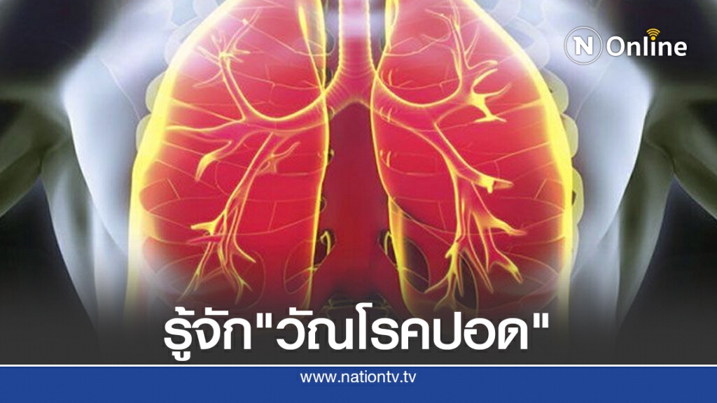 รู้จัก "วัณโรคปอด" ภัยเงียบ แพร่เชื้อง่าย รู้จัก "วัณโรคปอด" ภัยเงียบ แพร่เชื้อง่าย