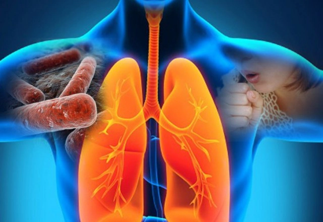 รู้จัก "วัณโรคปอด" ภัยเงียบ แพร่เชื้อง่าย