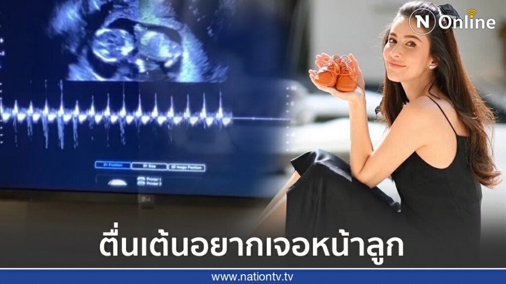 "ศรีริต้า" ตื่นเต้นสุดๆ โชว์ภาพอัลตร้าซาวด์ลูกน้อยได้ 13 สัปดาห์แล้ว "ศรีริต้า" ตื่นเต้นสุดๆ โชว์ภาพอัลตร้าซาวด์ลูกน้อยได้ 13 สัปดาห์แล้ว