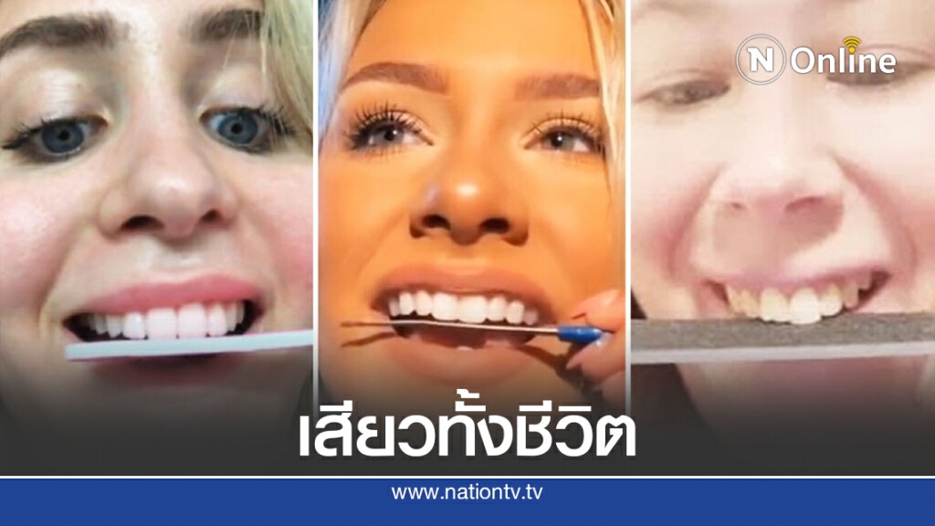 คิดได้อย่างไร ตะไบถูฟัน คิดได้อย่างไร ตะไบถูฟัน