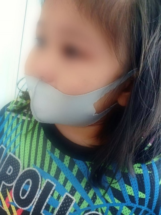 แม่แชร์อุทาหรณ์ หลังเห็นนิ้วเท้าลูกบวมแดง หาสาเหตุพบมีสัตว์แอบอยู่ในรองเท้า
