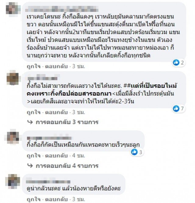 แม่แชร์อุทาหรณ์ หลังเห็นนิ้วเท้าลูกบวมแดง หาสาเหตุพบมีสัตว์แอบอยู่ในรองเท้า