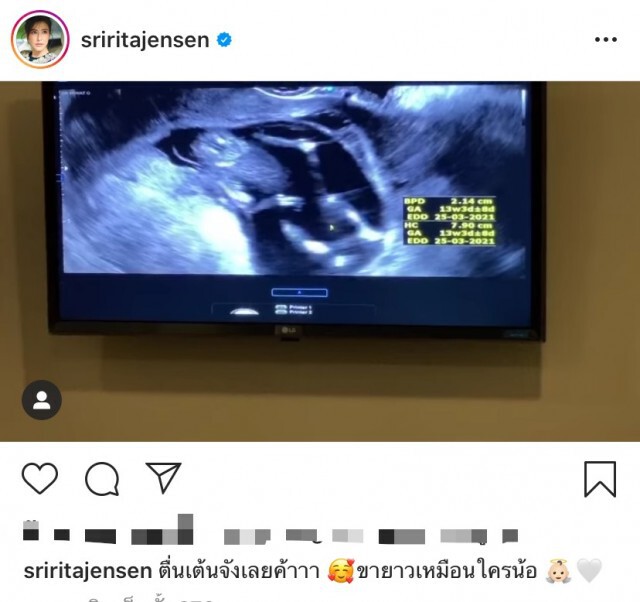 "ศรีริต้า" ตื่นเต้นสุดๆ โชว์ภาพอัลตร้าซาวด์ลูกน้อยได้ 13 สัปดาห์แล้ว