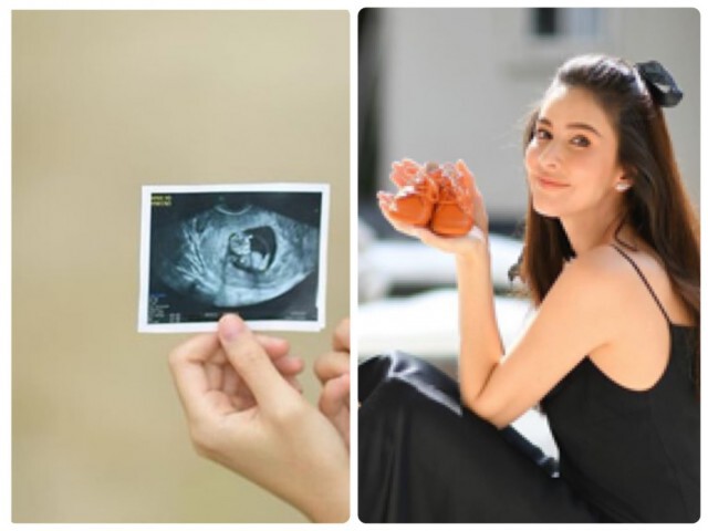 "ศรีริต้า" ตื่นเต้นสุดๆ โชว์ภาพอัลตร้าซาวด์ลูกน้อยได้ 13 สัปดาห์แล้ว