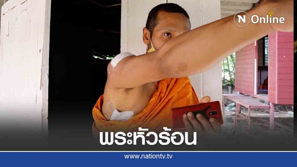 พระลูกวัดหัวร้อน เหล็กฟาดเจ้าอาวาสน่วม เย็บ 8 เข็ม