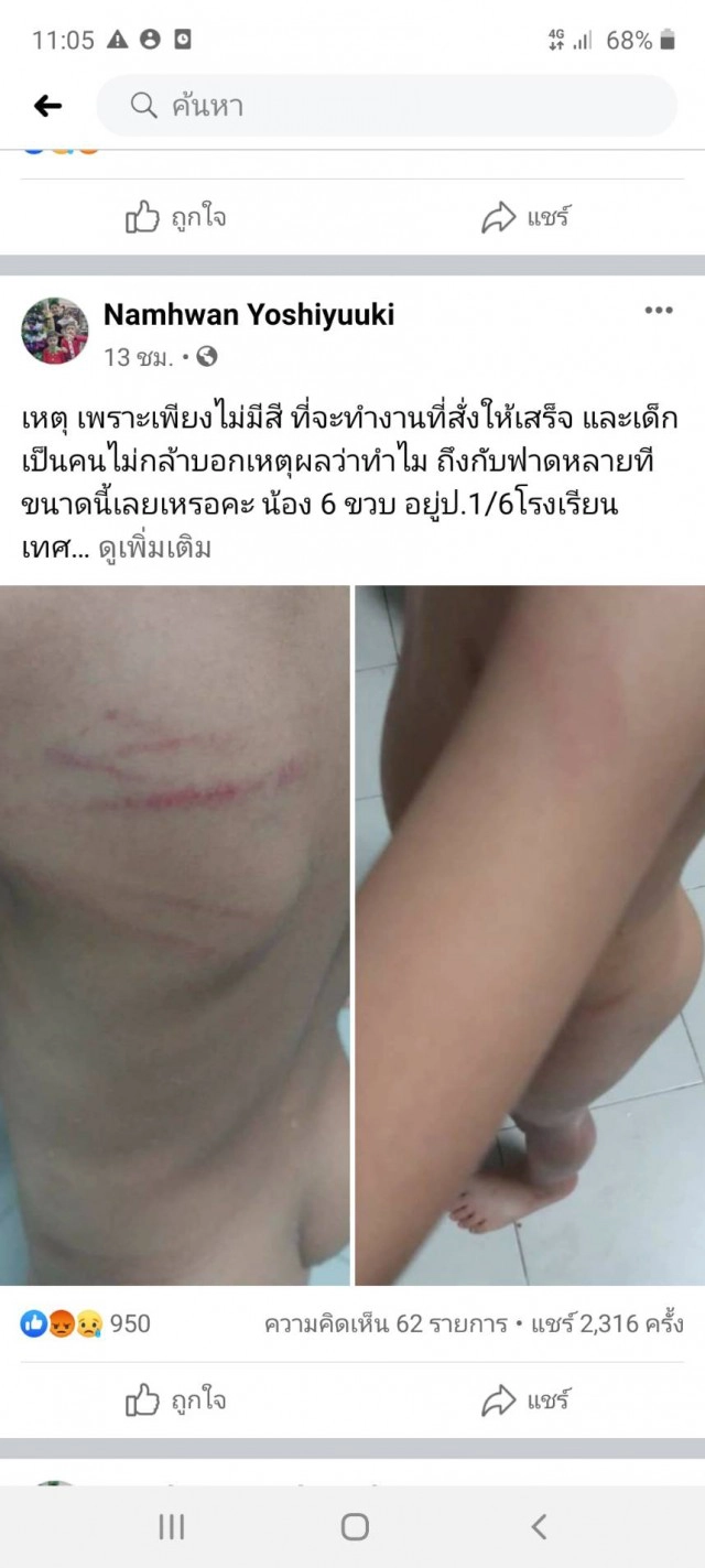 แรงไปไหม?? แม่ถามคุณครูตีลูกจนช้ำเลือด