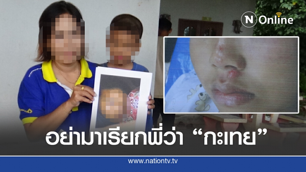 แม่ร้องลูกป.2 ถูกรุ่นพี่ ม.3 ทำร้าย รร.ไม่เหลียวแล