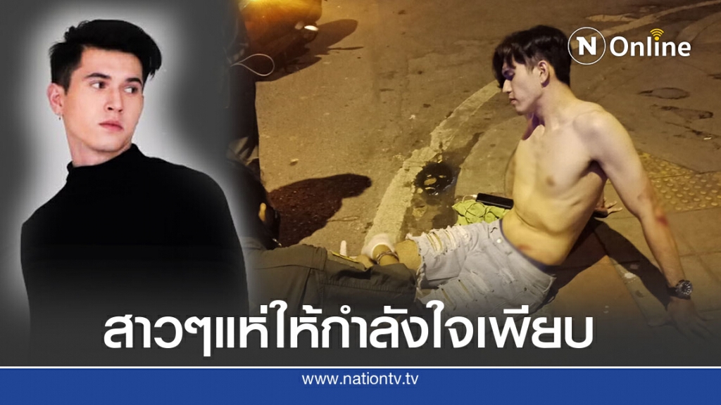 ชาวเน็ตฮือฮาหลังหนุ่มนายแบบเกิดอุบัติเหตุ จยย.ล้ม จนมีแต่คนอยากเจ็บแทน