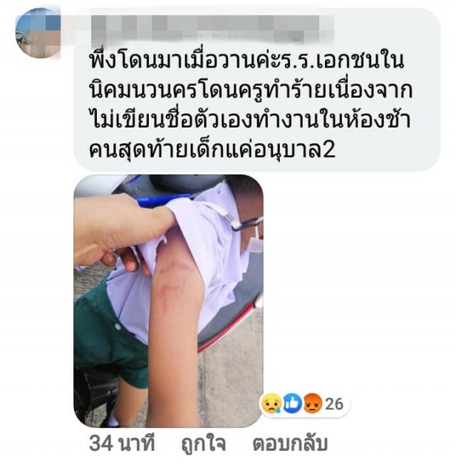 โผล่อีกราย แม่โพสต์ลูกชั้นอนุบาล 2 รร.เอกชนชื่อดัง ถูกครูทำร้าย พบร่องรอยคล้ายรอยหยิก