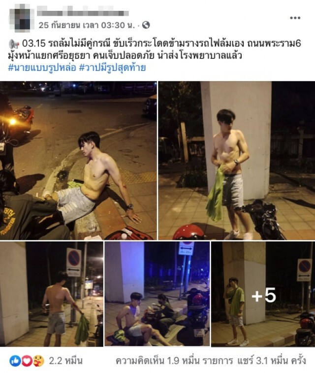 ชาวเน็ตฮือฮาหลังหนุ่มนายแบบเกิดอุบัติเหตุ จยย.ล้ม จนมีแต่คนอยากเจ็บแทน