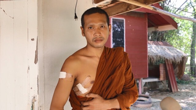 ฟ้องศาลแล้ว พระลูกวัดใช้ท่อนเหล็กตีเจ้าอาวาสเย็บ 8 เข็ม