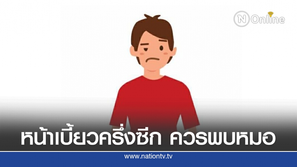 แพทย์เตือน หน้าเบี้ยวครึ่งซีกเกิดจากความผิดปกติของเส้นประสาท ควรรีบพบแพทย์