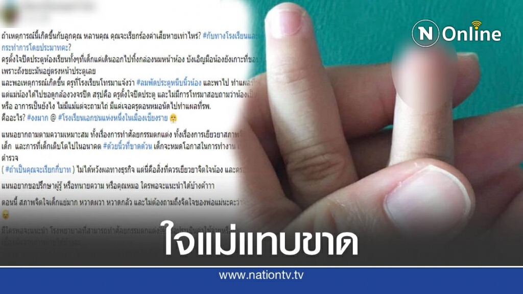 เอาอีกแล้ว ! สาวโพสต์แฉโรงเรียนดังปิดประตูหนีบนิ้วลูกขาด เอาอีกแล้ว ! สาวโพสต์แฉโรงเรียนดังปิดประตูหนีบนิ้วลูกขาด