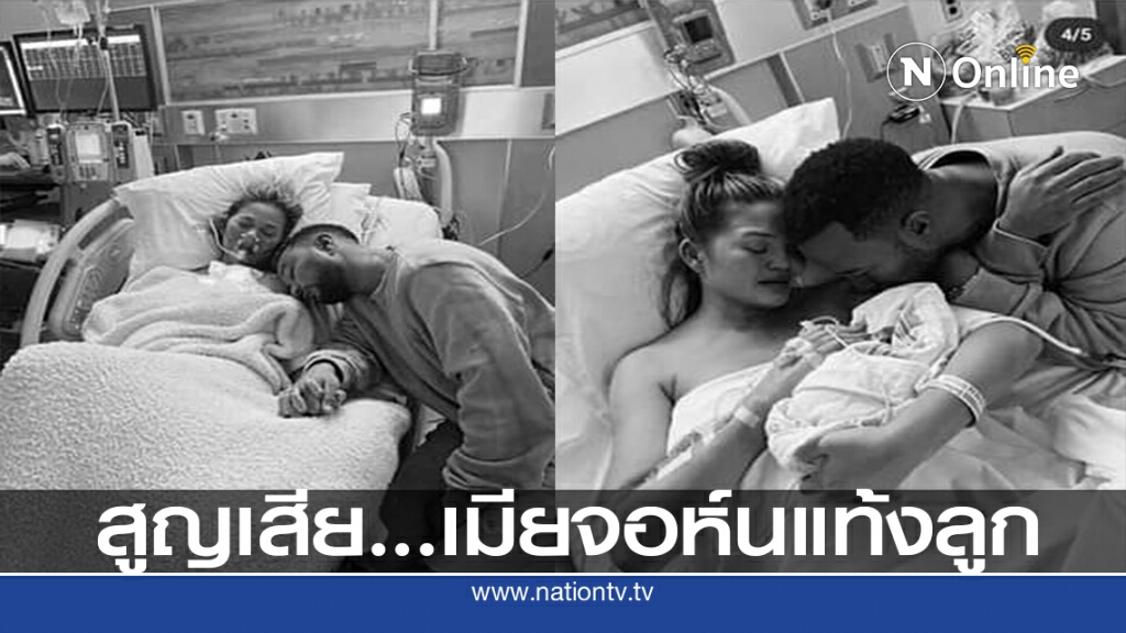 คริสซี ทีเกน ภรรยาจอห์น เลเจนด์ แท้ง