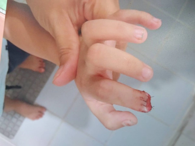 หวั่นซ้ำรอยหนีบนิ้ว-ติดพลาสติดกั้นประตูทุกห้อง