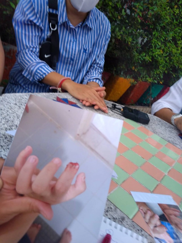 หวั่นซ้ำรอยหนีบนิ้ว-ติดพลาสติดกั้นประตูทุกห้อง