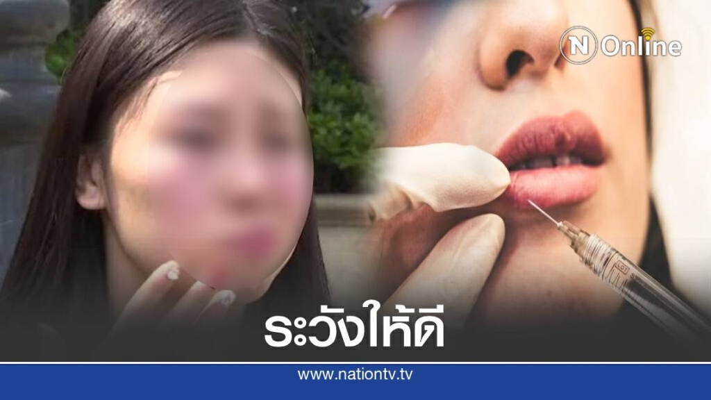 สาวจีนโดนฉีดฟิลเลอร์พลาด จนเป็นอัมพาตที่หน้า สาวจีนโดนฉีดฟิลเลอร์พลาด จนเป็นอัมพาตที่หน้า