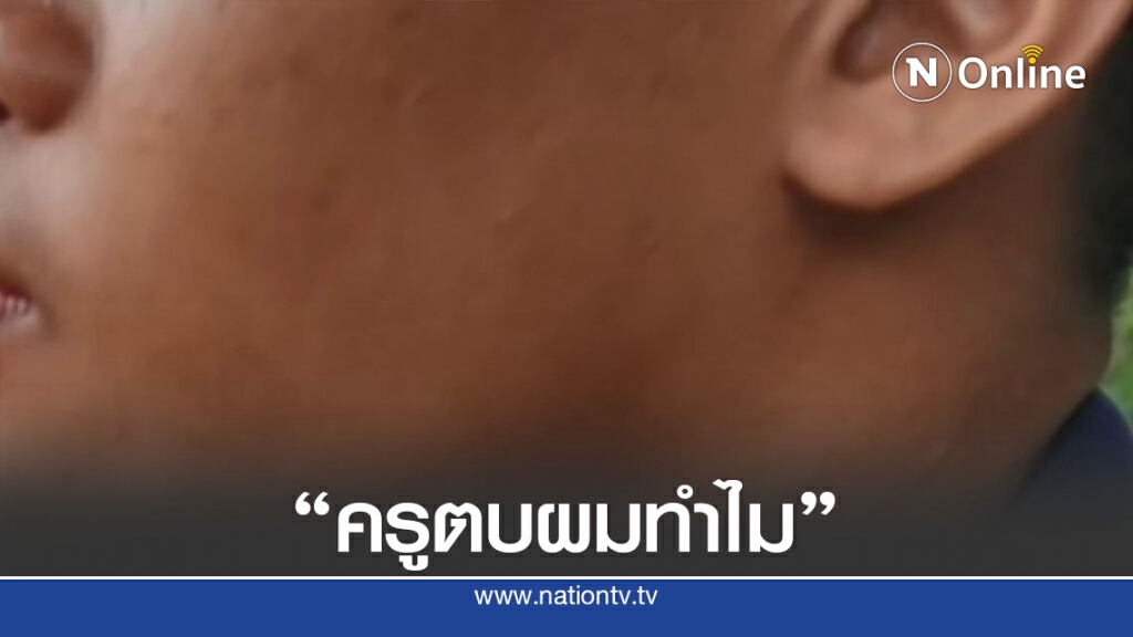 ครูหัวร้อนด่า-ตบหน้าเด็กม.2หลังรอขึ้นเวทีงานเกษียณ